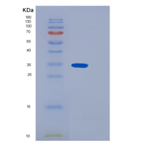 Recombinant Human N-acetyltransferase 6 Protein,Recombinant Human N-acetyltransferase 6 Protein