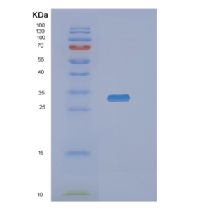 Recombinant Human NANP Protein