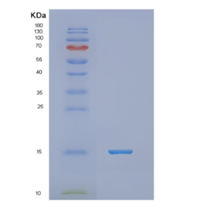 Recombinant Human NDP Protein,Recombinant Human NDP Protein