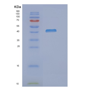 Recombinant Human NDRG3 Protein,Recombinant Human NDRG3 Protein