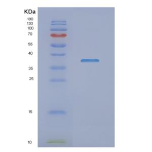 Recombinant Human NDUFAF1 Protein,Recombinant Human NDUFAF1 Protein