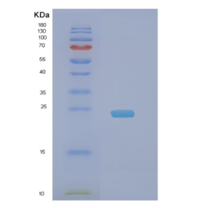 Recombinant Human NDUFB9 Protein