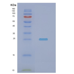 Recombinant Human NDUFV2 Protein,Recombinant Human NDUFV2 Protein