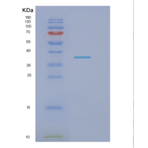 Recombinant Human Nectin-1 Protein