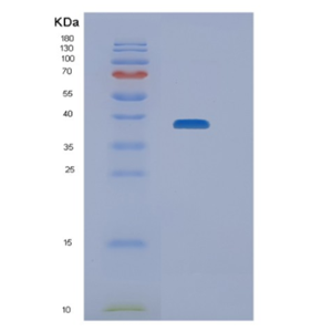 Recombinant Human NEIL2 Protein