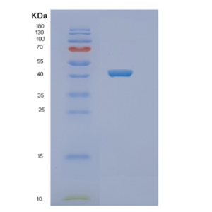 Recombinant Human NEU1 Protein,Recombinant Human NEU1 Protein