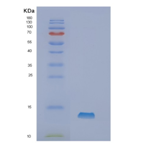 Recombinant Human Neurokinin B Protein