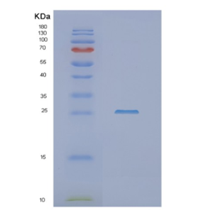 Recombinant Human NHEJ1 Protein,Recombinant Human NHEJ1 Protein