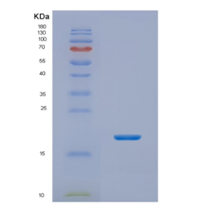 Recombinant Human NHP2 Protein