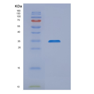 Recombinant Human NIPSNAP1 Protein,Recombinant Human NIPSNAP1 Protein