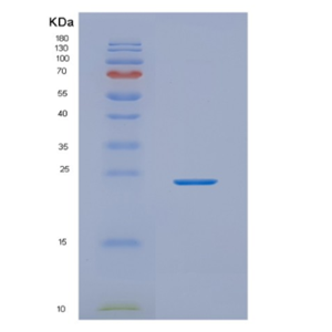 Recombinant Human NKIRAS2 Protein,Recombinant Human NKIRAS2 Protein