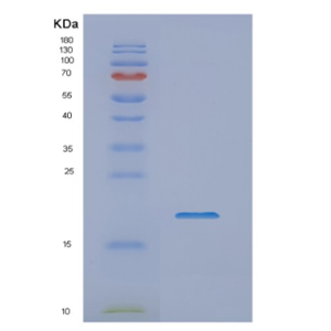 Recombinant Human NME1 Protein