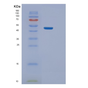 Recombinant Human NELFE Protein,Recombinant Human NELFE Protein