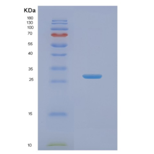 Recombinant Human NABP1 Protein,Recombinant Human NABP1 Protein