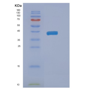 Recombinant Human NAIF1 Protein,Recombinant Human NAIF1 Protein