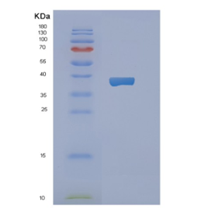 Recombinant Human NAPG Protein,Recombinant Human NAPG Protein