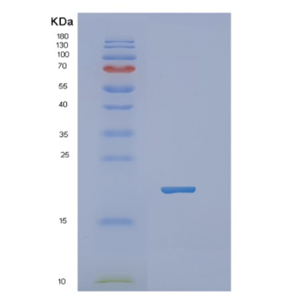 Recombinant Human NBL1 Protein,Recombinant Human NBL1 Protein