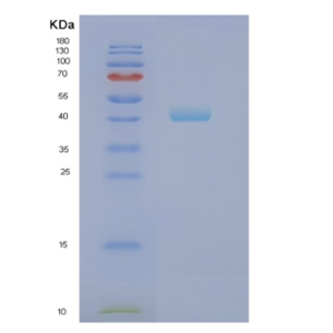 Recombinant Human NCF1 Protein,Recombinant Human NCF1 Protein