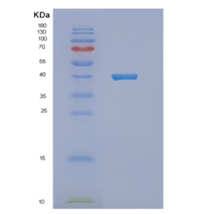 Recombinant Human NDE1 Protein