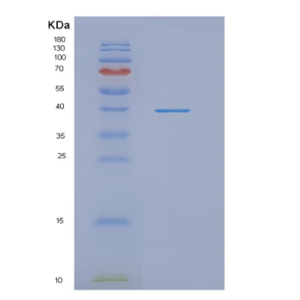 Recombinant Human NDRG1 Protein,Recombinant Human NDRG1 Protein