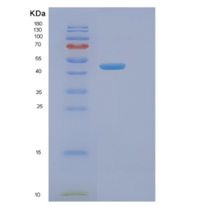 Recombinant Human NAGA Protein,Recombinant Human NAGA Protein