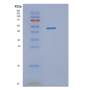 Recombinant Human NAP1L1 Protein,Recombinant Human NAP1L1 Protein