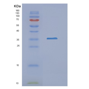 Recombinant Human NAT1 Protein,Recombinant Human NAT1 Protein