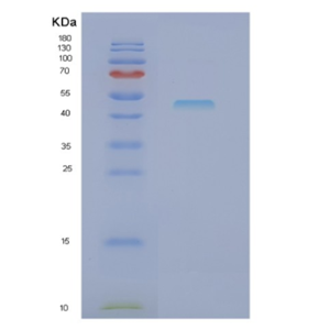 Recombinant Human NCK1 Protein