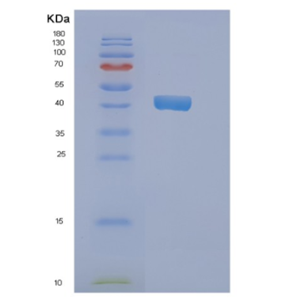 Recombinant Human NDRG2 Protein,Recombinant Human NDRG2 Protein