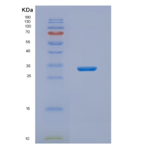 Recombinant Human NIT2 Protein