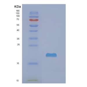 Recombinant Human NME3 Protein