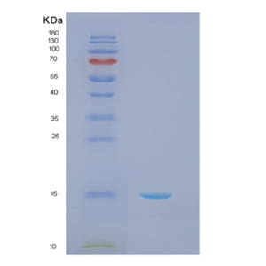 Recombinant Human NCR2 Protein