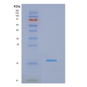 Recombinant Human NME2 Protein,Recombinant Human NME2 Protein