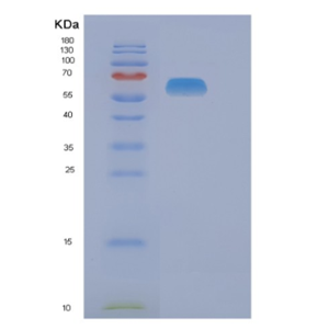 Recombinant Human NAE1 Protein,Recombinant Human NAE1 Protein