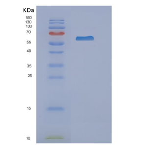 Recombinant Human NARS Protein,Recombinant Human NARS Protein