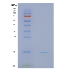 Recombinant Human NDFIP1 Protein,Recombinant Human NDFIP1 Protein