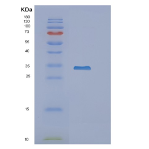 Recombinant Mouse Nnmt Protein