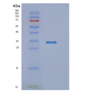 Recombinant Mouse Nnmt Protein,Recombinant Mouse Nnmt Protein