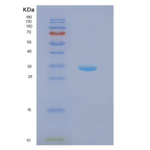 Recombinant Human NPM1 Protein,Recombinant Human NPM1 Protein