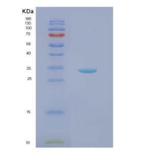 Recombinant Human NQO1 Protein,Recombinant Human NQO1 Protein