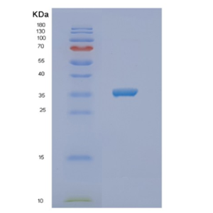 Recombinant Human NSDHL Protein