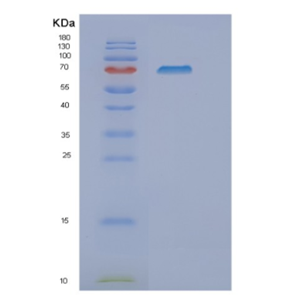 Recombinant Human NT5C2 Protein,Recombinant Human NT5C2 Protein