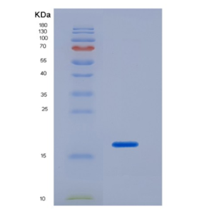 Recombinant Neurotrophin 4 (NT4),Recombinant Neurotrophin 4 (NT4)