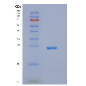 Recombinant Human NUDT16 Protein,Recombinant Human NUDT16 Protein