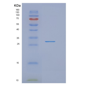 Recombinant Human NUDT21 Protein