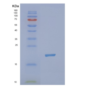 Recombinant Human NUDT3 Protein