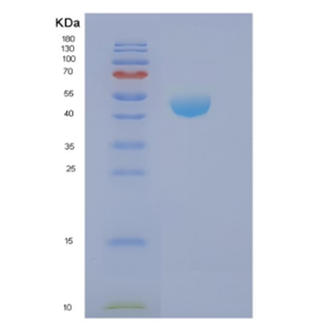 Recombinant Human NCK2 Protein,Recombinant Human NCK2 Protein