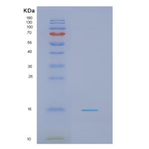 Recombinant Human NDUFS5 Protein,Recombinant Human NDUFS5 Protein