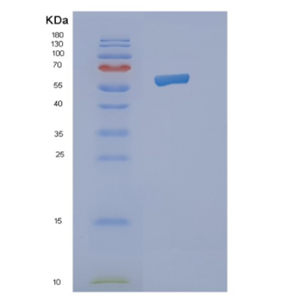 Recombinant Human NMT2 Protein