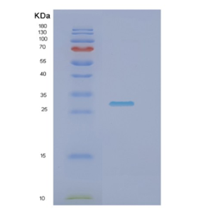 Recombinant Human NRIP3 Protein